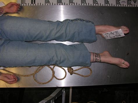 herdeaths.net|female genitalia actual photos medical.
